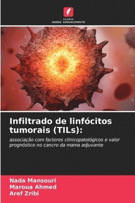 Infiltrado de linfcitos tumorais (TILs) 1