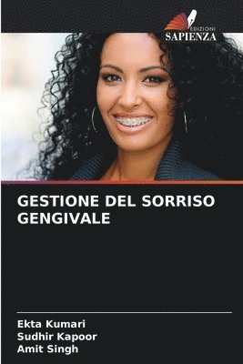 bokomslag Gestione del Sorriso Gengivale