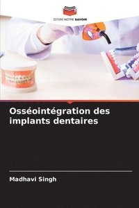 bokomslag Ossointgration des implants dentaires