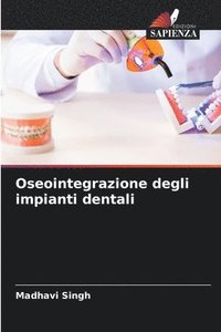 bokomslag Oseointegrazione degli impianti dentali