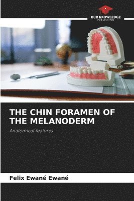 The Chin Foramen of the Melanoderm 1