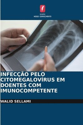 Infeco Pelo Citomegalovrus Em Doentes Com Imunocompetente 1