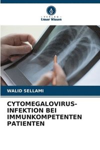 bokomslag Cytomegalovirus-Infektion Bei Immunkompetenten Patienten
