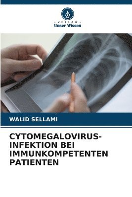 Cytomegalovirus-Infektion Bei Immunkompetenten Patienten 1