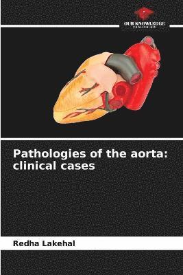 Pathologies of the aorta 1