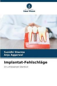 bokomslag Implantat-Fehlschlge
