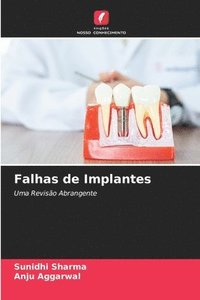 bokomslag Falhas de Implantes
