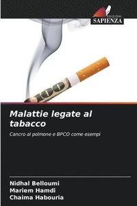 bokomslag Malattie legate al tabacco