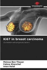bokomslag Ki67 in breast carcinoma