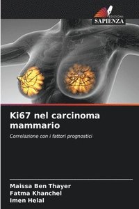 bokomslag Ki67 nel carcinoma mammario