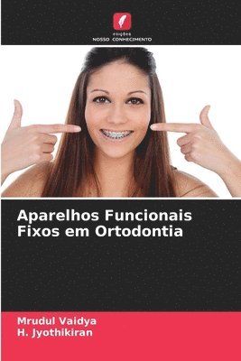 Aparelhos Funcionais Fixos em Ortodontia 1