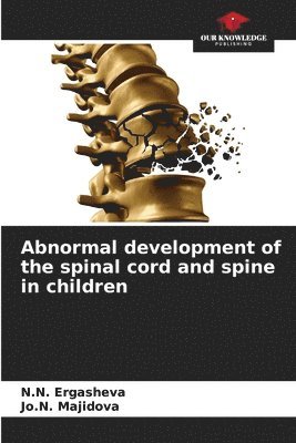 Abnormal development of the spinal cord and spine in children 1