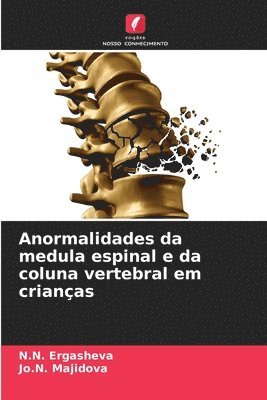 bokomslag Anormalidades da medula espinal e da coluna vertebral em crianas