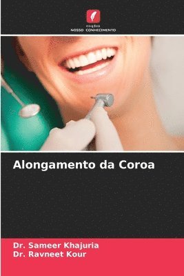 Alongamento da Coroa 1