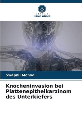 Knocheninvasion bei Plattenepithelkarzinom des Unterkiefers 1