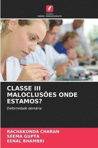 bokomslag Classe III Malocluses Onde Estamos?