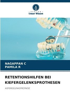 bokomslag Retentionshilfen Bei Kiefergelenksprothesen