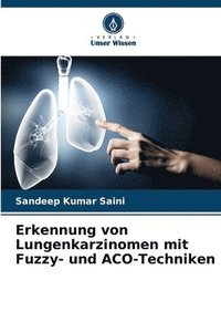 bokomslag Erkennung von Lungenkarzinomen mit Fuzzy- und ACO-Techniken