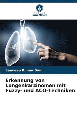 Erkennung von Lungenkarzinomen mit Fuzzy- und ACO-Techniken 1