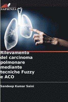 bokomslag Rilevamento del carcinoma polmonare mediante tecniche Fuzzy e ACO