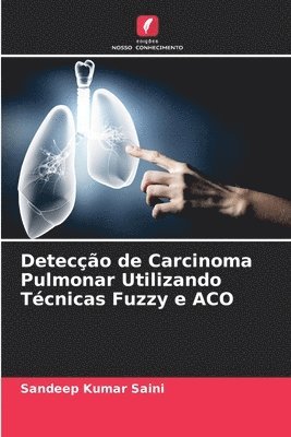 bokomslag Deteco de Carcinoma Pulmonar Utilizando Tcnicas Fuzzy e ACO