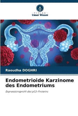 Endometrioide Karzinome des Endometriums 1