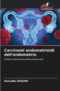 bokomslag Carcinomi endometrioidi dell'endometrio
