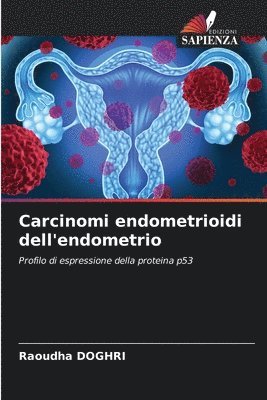 Carcinomi endometrioidi dell'endometrio 1