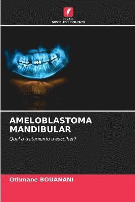 bokomslag Ameloblastoma Mandibular