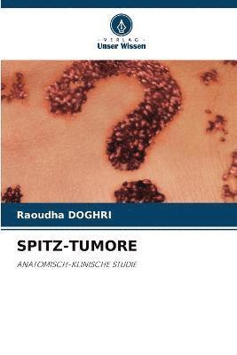 Spitz-Tumore 1