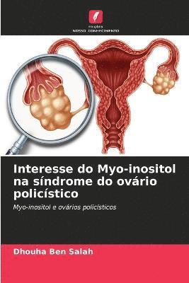 Interesse do Myo-inositol na sndrome do ovrio policstico 1