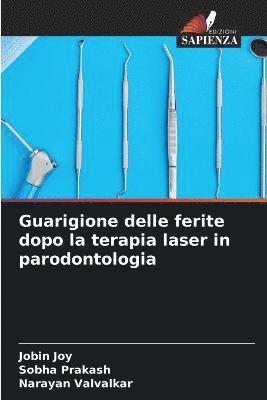 bokomslag Guarigione delle ferite dopo la terapia laser in parodontologia