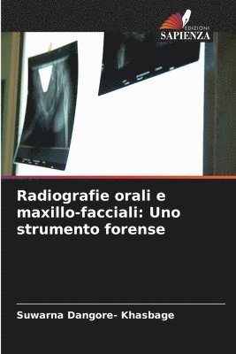 bokomslag Radiografie orali e maxillo-facciali