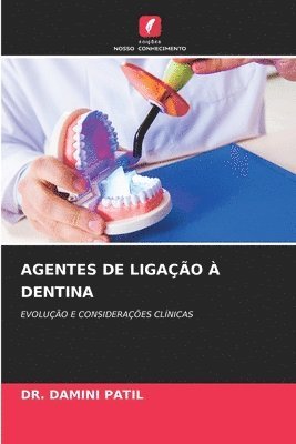 Agentes de Ligao  Dentina 1