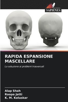 bokomslag Rapida Espansione Mascellare