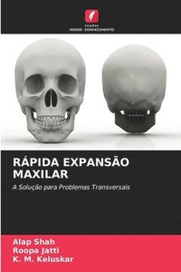 bokomslag Rpida Expanso Maxilar