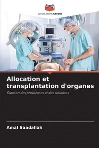 bokomslag Allocation et transplantation d'organes