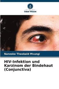 bokomslag HIV-Infektion und Karzinom der Bindehaut (Conjunctiva)