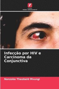 bokomslag Infeco por HIV e Carcinoma da Conjunctiva