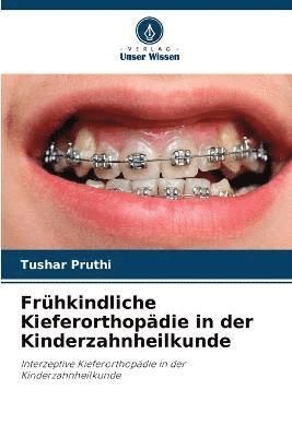 Tushar Pruthi, Monika Gupta, Inder Kumar Pandit - Frühkindliche Kieferorthopädie in der Kinderzahnheilkunde, Häftad
