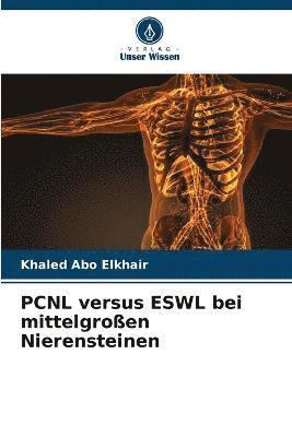 bokomslag PCNL versus ESWL bei mittelgroen Nierensteinen