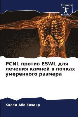 bokomslag Pcnl &#1087;&#1088;&#1086;&#1090;&#1080;&#1074; Eswl &#1076;&#1083;&#1103; &#1083;&#1077;&#1095;&#1077;&#1085;&#1080;&#1103; &#1082;&#1072;&#1084;&#1085;&#1077;&#1081; &#1074;