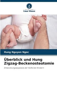 bokomslag berblick und Hung Zigzag-Beckenosteotomie