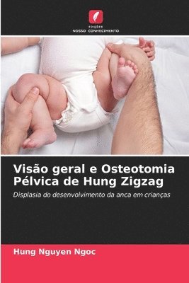 Viso geral e Osteotomia Plvica de Hung Zigzag 1