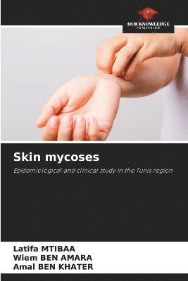 Skin mycoses 1