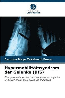 bokomslag Hypermobilitätssyndrom der Gelenke (JHS)