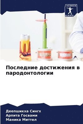Деепшикха Сингх, Арпита Госвами, Маника Миттел, &#1 &#1057;&#1080;&#1085;&#1075;&#1093;, &#1043;&#1086;&#1089;&#1074;&#1072;&#108, ¿¿¿¿¿¿¿¿¿ ¿¿¿¿¿, ¿¿¿¿¿¿ ¿¿¿¿¿¿¿, Deepshikha Singh - Последние достижения в пародонтологии, Häftad