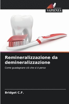 Remineralizzazione da demineralizzazione 1