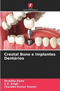 bokomslag Crestal Bone e Implantes Dentrios