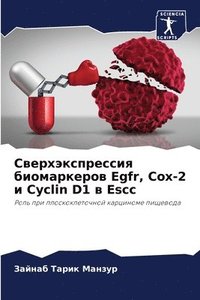 bokomslag &#1057;&#1074;&#1077;&#1088;&#1093;&#1101;&#1082;&#1089;&#1087;&#1088;&#1077;&#1089;&#1089;&#1080;&#1103; &#1073;&#1080;&#1086;&#1084;&#1072;&#1088;&#1082;&#1077;&#1088;&#1086;&#1074; Egfr, Cox-2